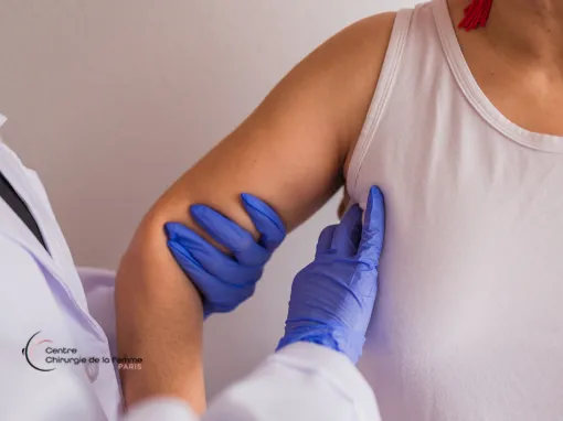 signes du cancer du sein